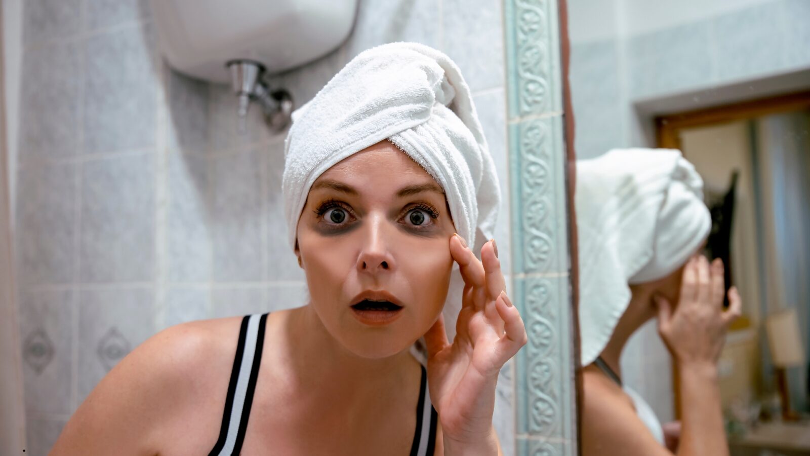 Mata Panda Penyebab Cara Menghilangkan Lingkar Hitam di Bawah Mata Secara Alami dan Medis