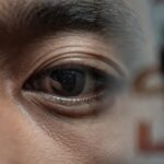 Kedutan Kelopak Mata Kanan Pertanda Apa Menurut Primbon & Medis