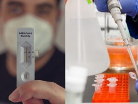Rapid Antigen vs PCR Perbedaan, Kegunaan, dan Kapan Harus Pakai di 2026